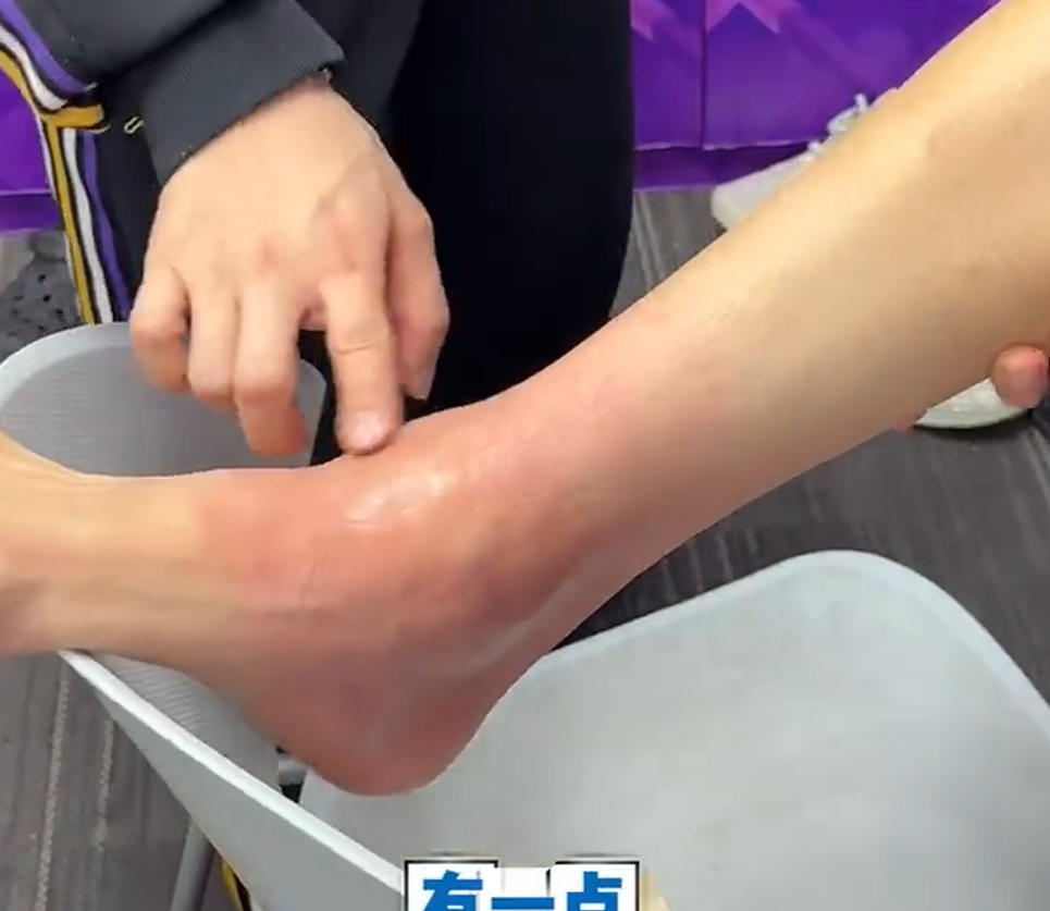 乐鱼体育官网-沈梓捷伤情更新！没去医院，本人亲承一直腿麻，伤的同一只脚！
